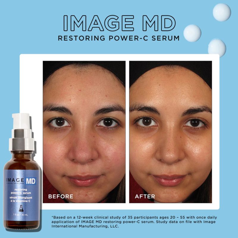 IMAGEMD restoringpower Cserum 1