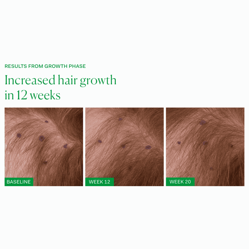 growth phase single the nue co 972951